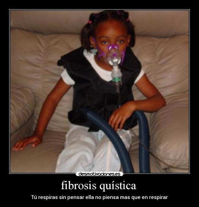 fibrosis quística  - 