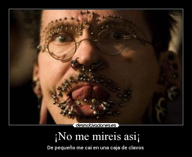 ¡No me mireis asi¡ - De pequeño me cai en una caja de clavos