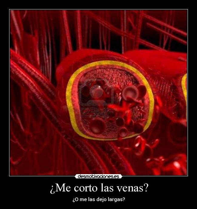 ¿Me corto las venas? -