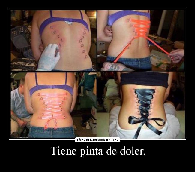 Tiene pinta de doler. - 