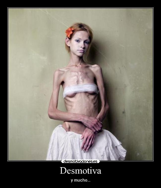 carteles anorexiadelgadaintentarevitar desmotivaciones