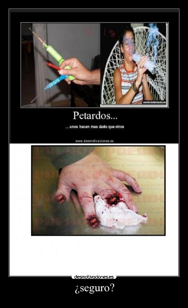 ¿seguro? -