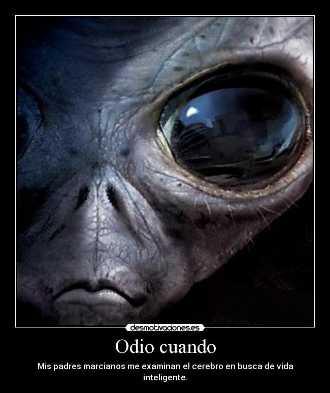 Odio cuando - Mis padres marcianos me examinan el cerebro en busca de vida inteligente.