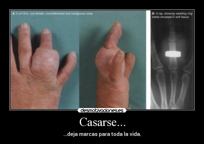 Casarse... - 