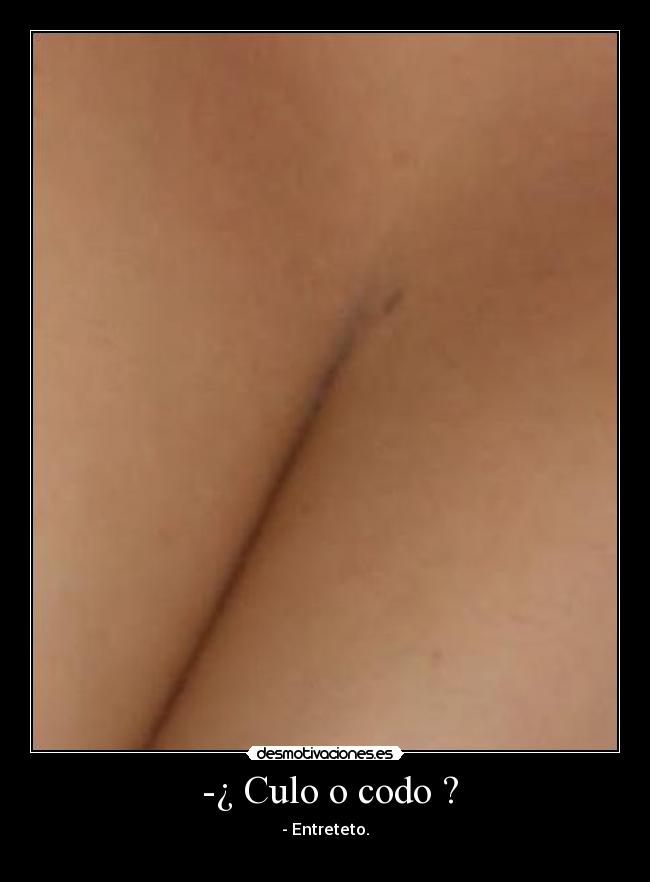 -¿ Culo o codo ? - - Entreteto.