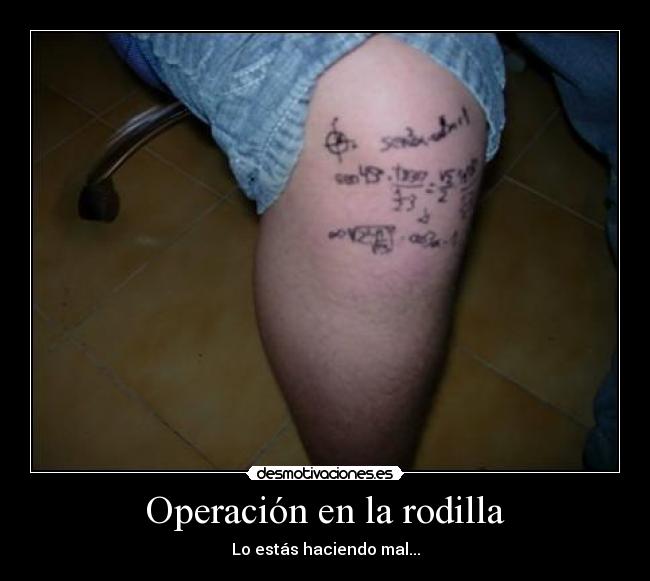 Operación en la rodilla - 