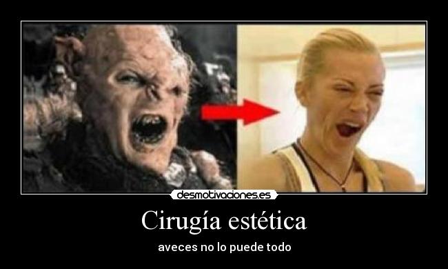 Cirugía estética -