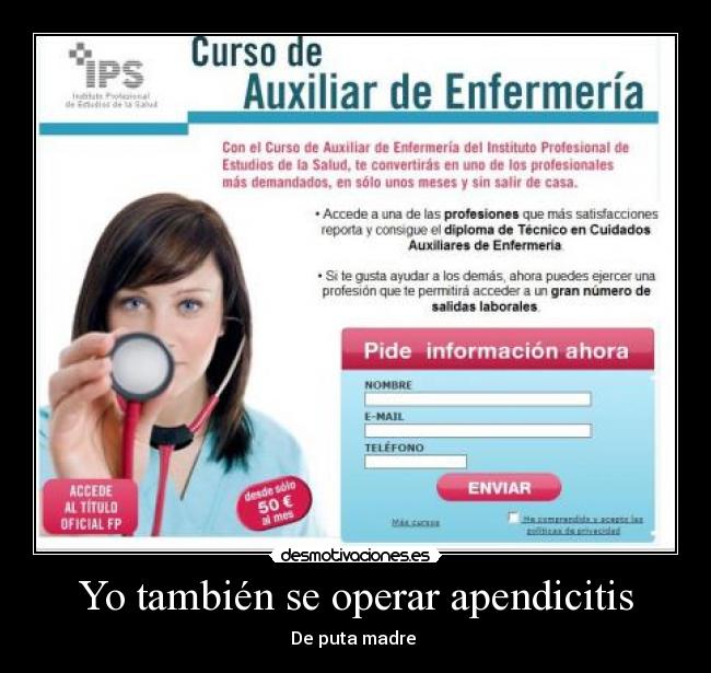 Yo también se operar apendicitis - De puta madre 