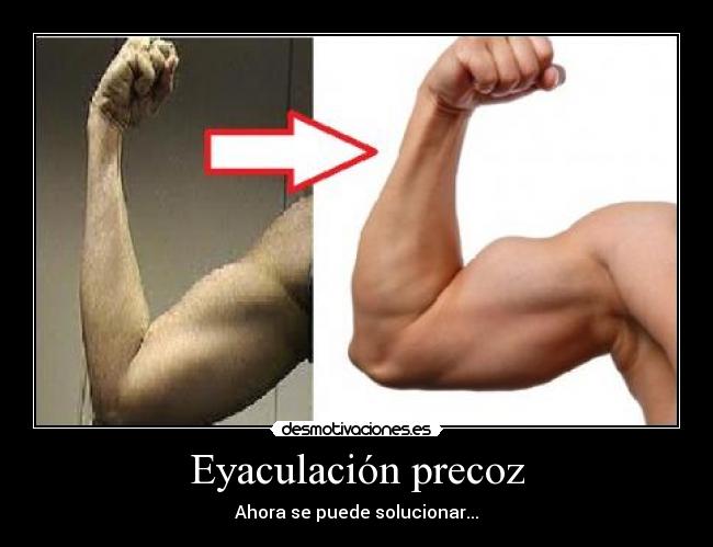 carteles eyaculacion precoz desmotivaciones