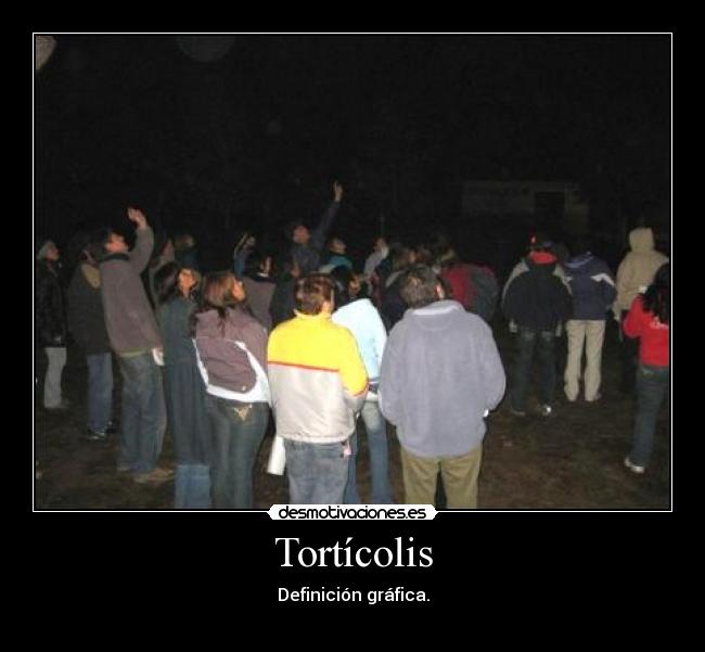 Tortícolis -