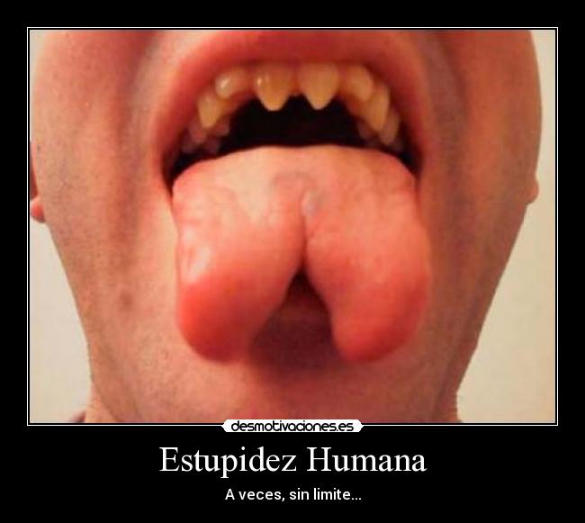 Estupidez Humana -