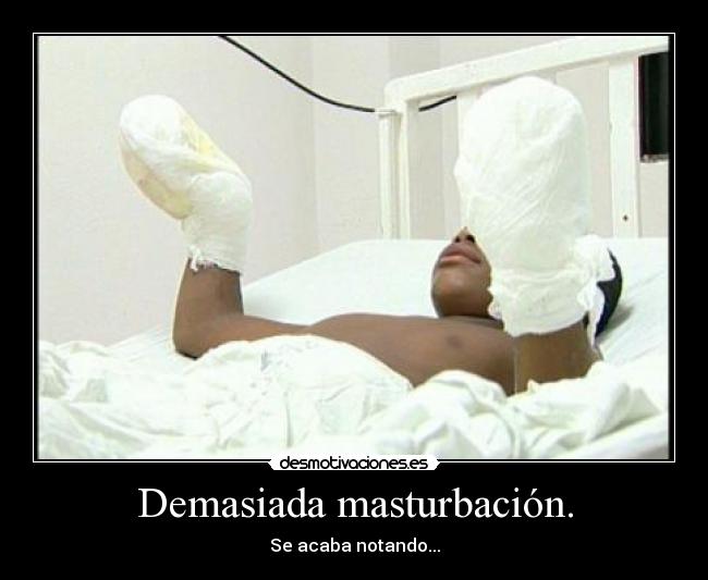 Demasiada masturbación. - 