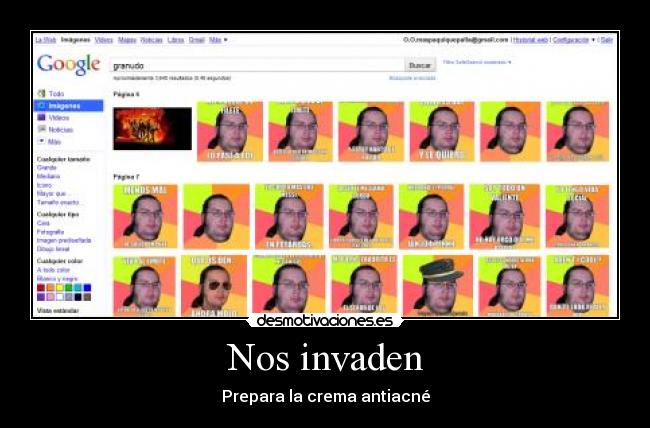 Nos invaden - Prepara la crema antiacné