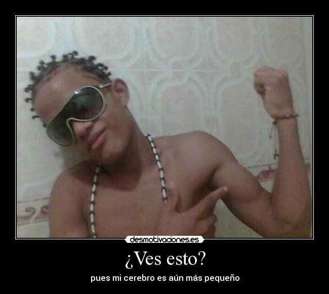 ¿Ves esto? - pues mi cerebro es aún más pequeño