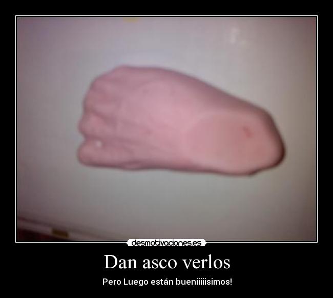 Dan asco verlos -