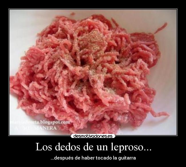 Los dedos de un leproso... -