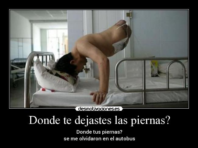 Donde te dejastes las piernas? -