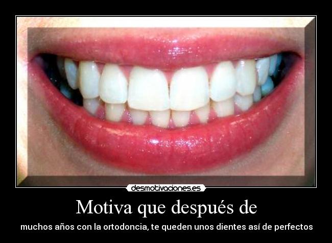 Motiva que después de -