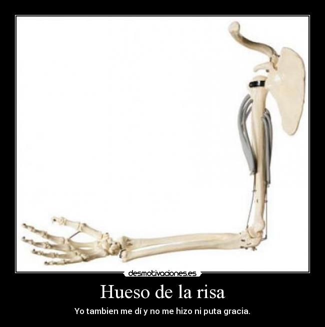 Hueso de la risa - Yo tambien me dí y no me hizo ni puta gracia.