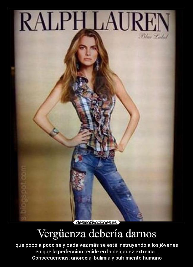 Vergüenza debería darnos - que poco a poco se y cada vez más se esté instruyendo a los jóvenes
en que la perfección reside en la delgadez extrema...
Consecuencias: anorexia, bulimia y sufrimiento humano