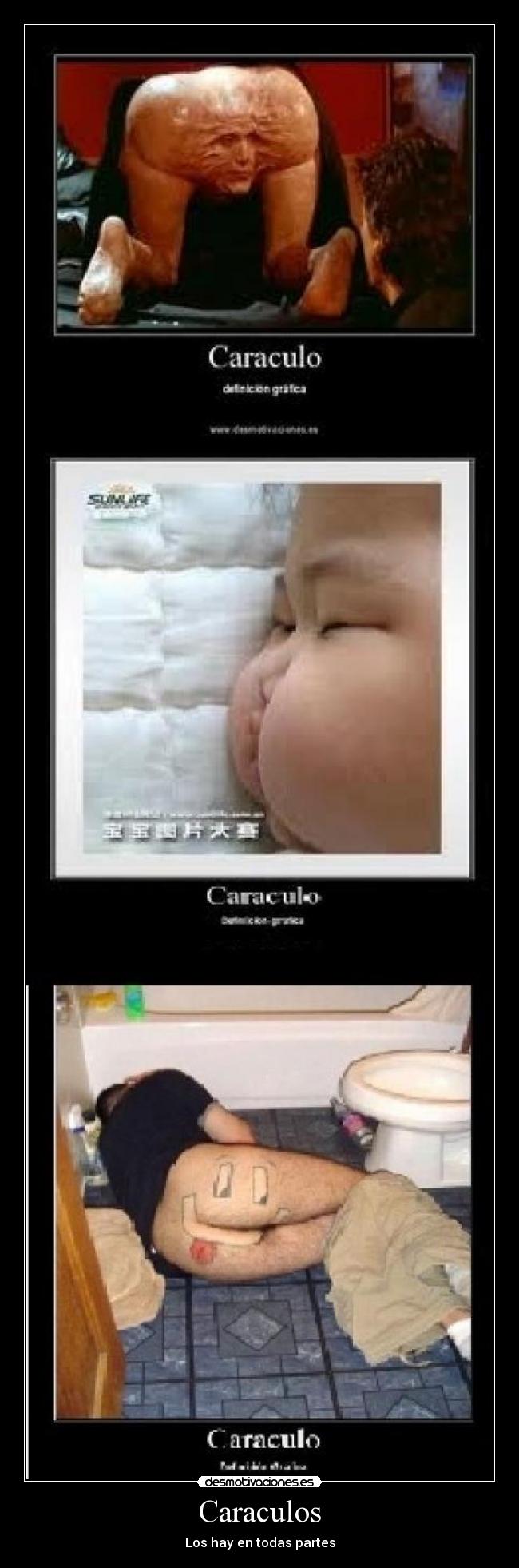 Caraculos - Los hay en todas partes