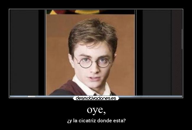 oye, - ¿y la cicatriz donde esta?