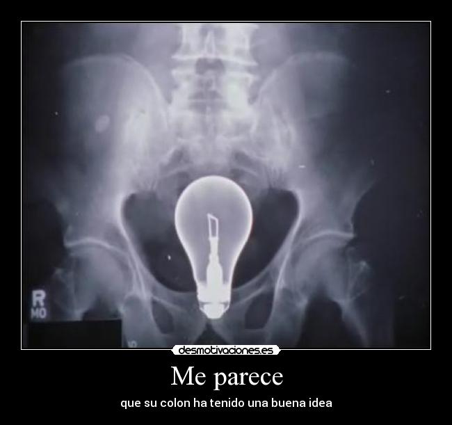 Me parece - que su colon ha tenido una buena idea