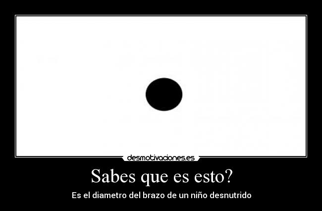 Sabes que es esto? - Es el diametro del brazo de un niño desnutrido
