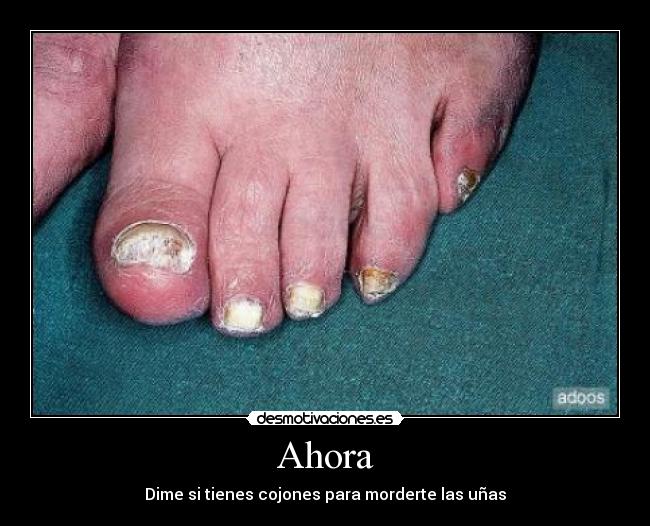 Ahora - Dime si tienes cojones para morderte las uñas