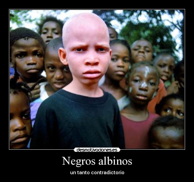 Negros albinos - un tanto contradictorio