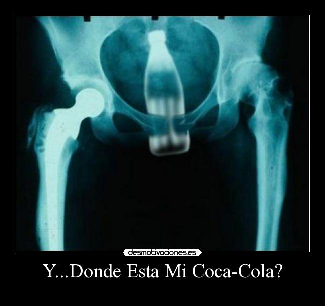 Y...Donde Esta Mi Coca-Cola? - 