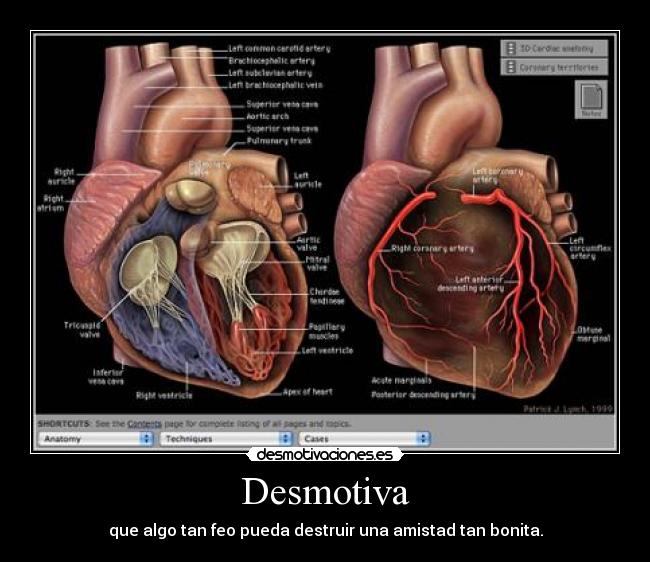 Desmotiva - que algo tan feo pueda destruir una amistad tan bonita.