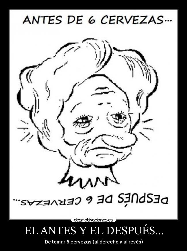 EL ANTES Y EL DESPUÉS... - De tomar 6 cervezas (al derecho y al revés)