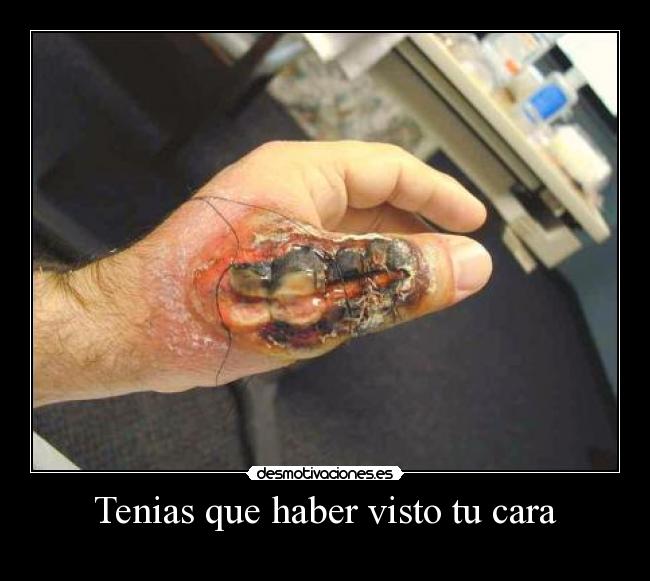 Tenias que haber visto tu cara -