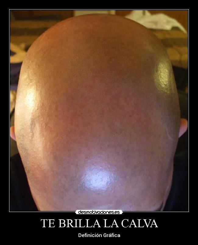 TE BRILLA LA CALVA -