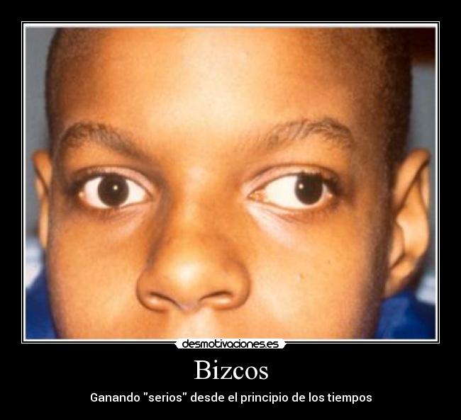 Bizcos - Ganando serios desde el principio de los tiempos