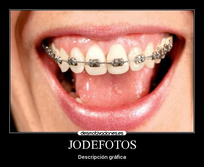 JODEFOTOS - Descripción gráfica