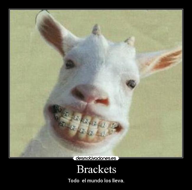 Brackets - Todo el mundo los lleva.