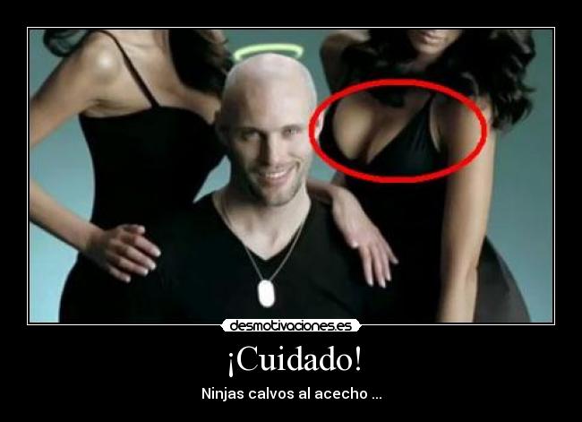 ¡Cuidado! -