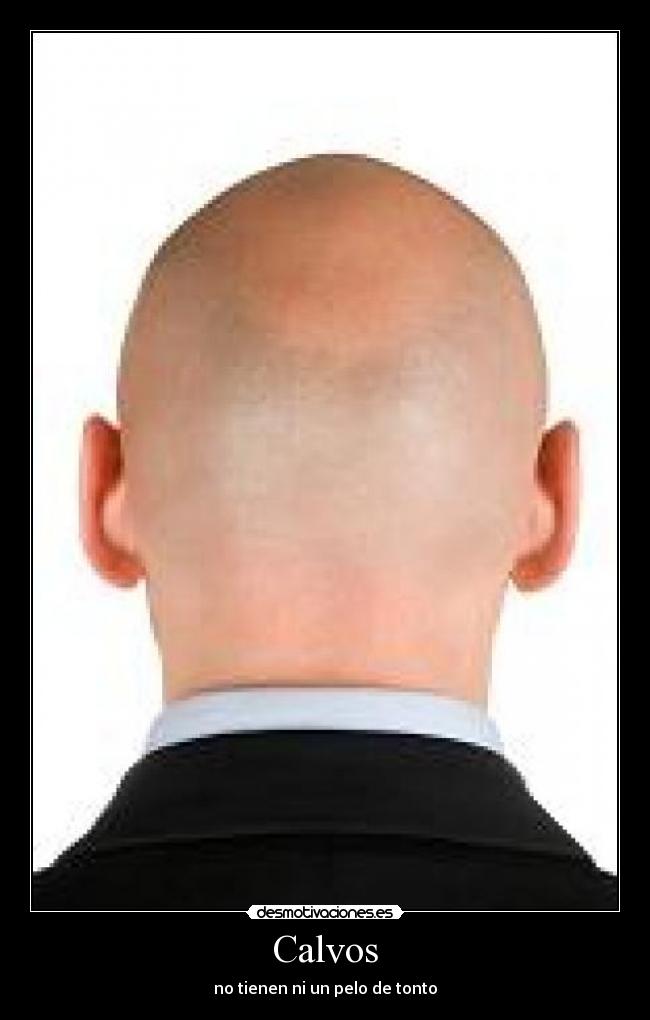 Calvos -