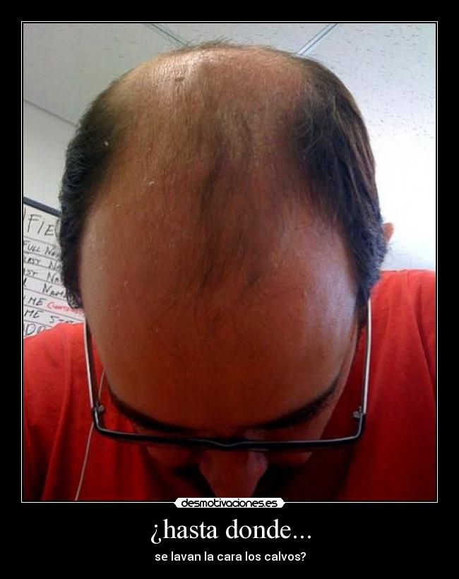 ¿hasta donde... - se lavan la cara los calvos?