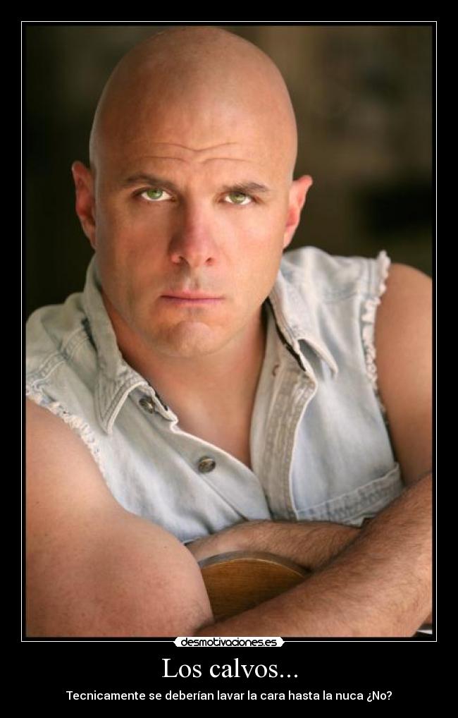 Dudas sobre calvos