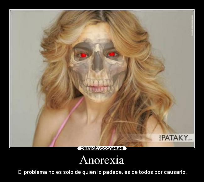Anorexia - 