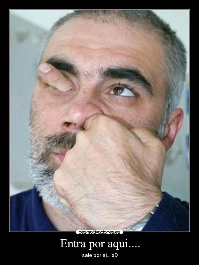 Entra por aqui.... - 