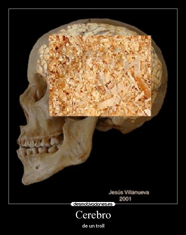 Cerebro -