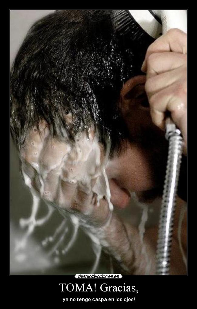 TOMA! Gracias, - ya no tengo caspa en los ojos!