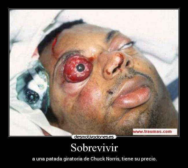 Sobrevivir - a una patada giratoria de Chuck Norris, tiene su precio.