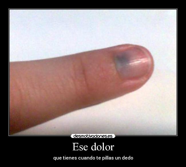 Ese dolor -