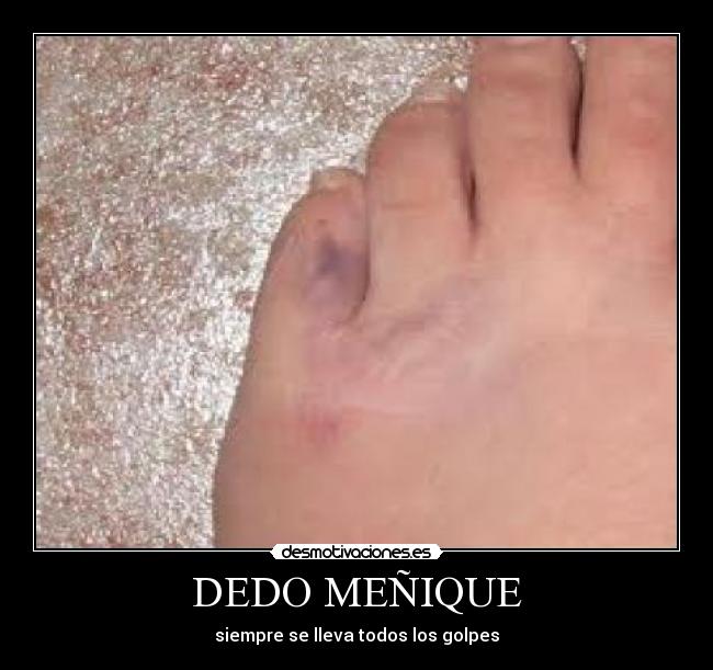 DEDO MEÑIQUE -