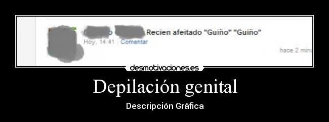 Depilación genital -
